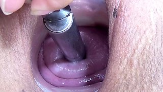 Cervix and Pee Hole Inflation with Injections for Japan Les