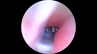 Camera in the! Exploring Gianna