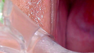 Silicone Sex Bomb Gets Treatment for Her Irritated Cervix