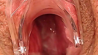 Gyno Fetish Searching Cervix - Wide Opened Pussy with Gyno Mirror